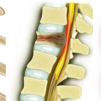 omurga _tumorleri-BANNER